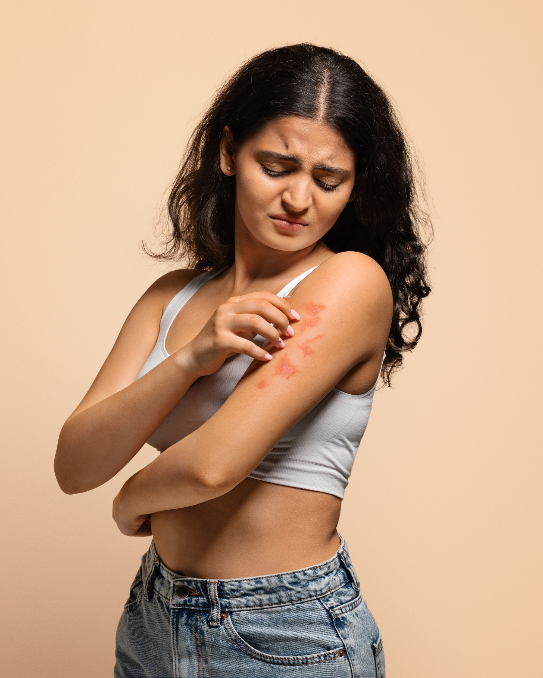 Ekzemë, Psoriazë & Vitiligo | Produkte Dermatologjike – Amar.al