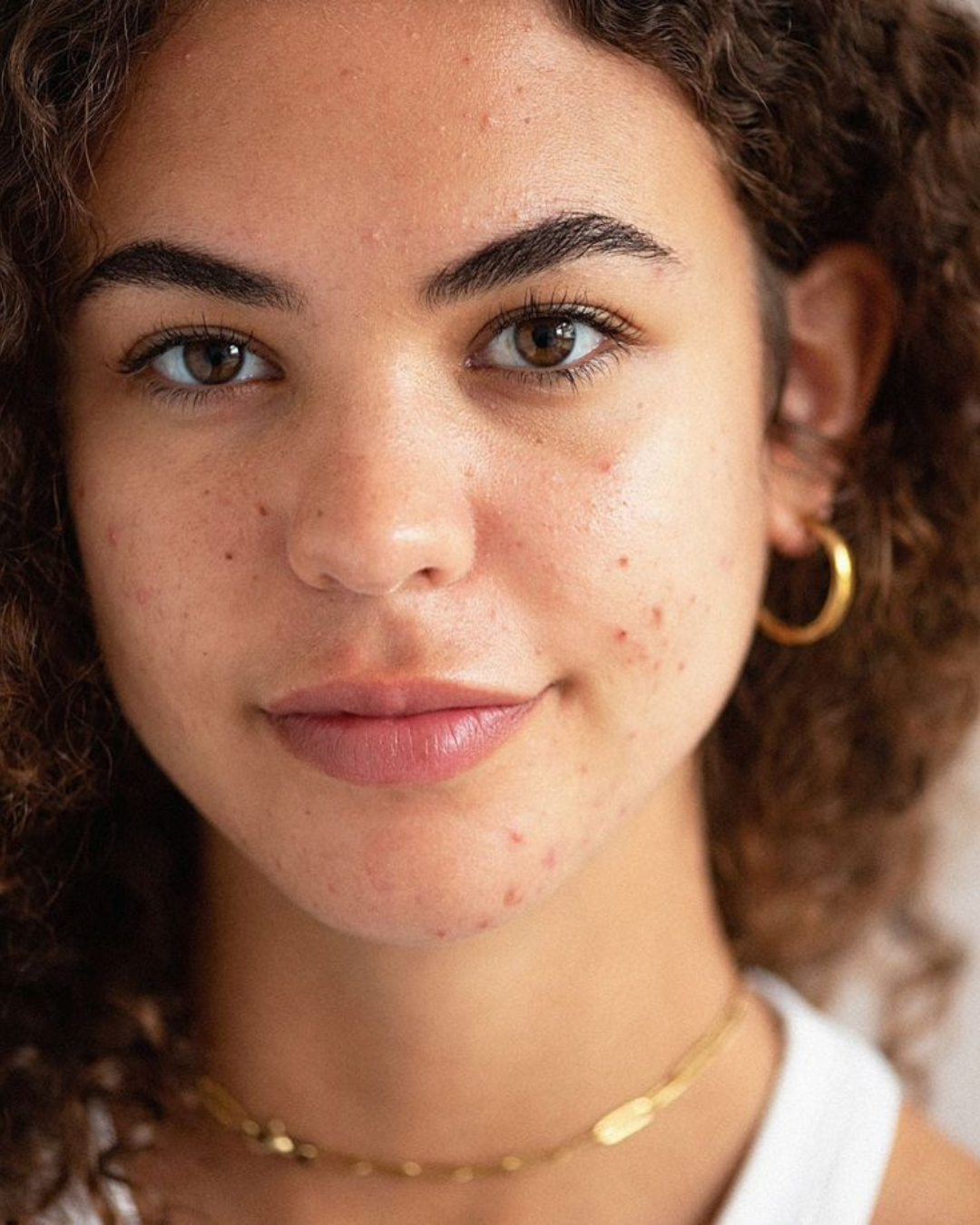 Lëkurë e Yndyrshme | Produkte për Kontrollin e Sebumit dhe Pastrim – Amar.al