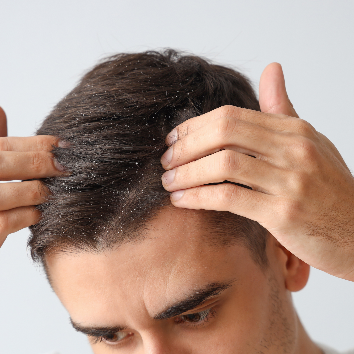 Pharmaceris DS – Trajtim i Specializuar për Dermatitin Seborroik | Amar.al