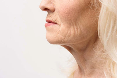 Rrudha të thella, lëkurë e varur